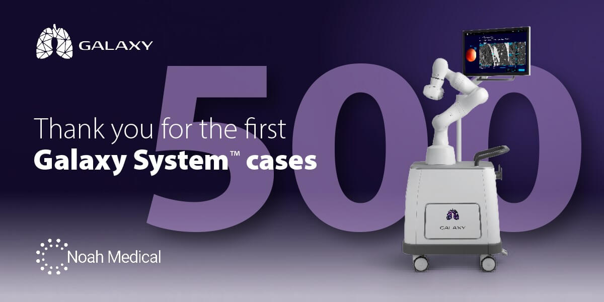 Noah Galaxy 500th case